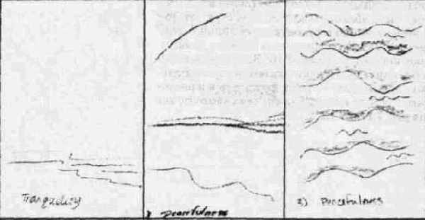    (18191904)